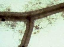 Figure 4.2. Root heavily infected with mycorrhizal fungi (note round spores at the end of some hyphae).