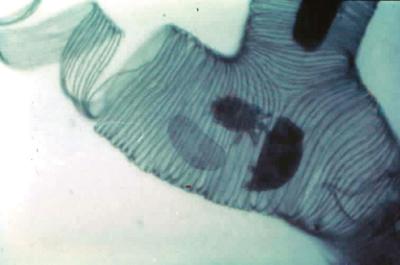 A honey bee’s airway passage (tracheal tubes) infested with acarine tracheal mites (Acarapis woodi).