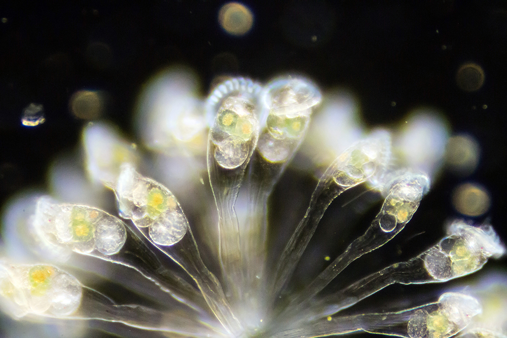 Magnified view of Rotifer colony