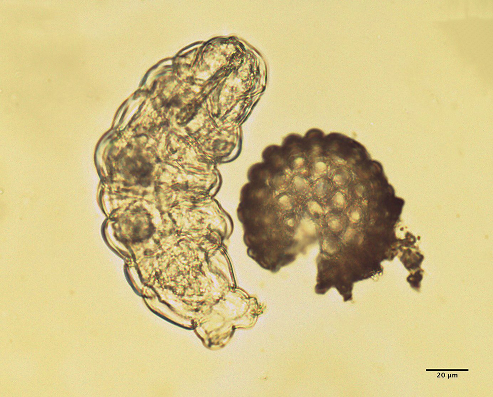 Microscopic view of tardigrade
