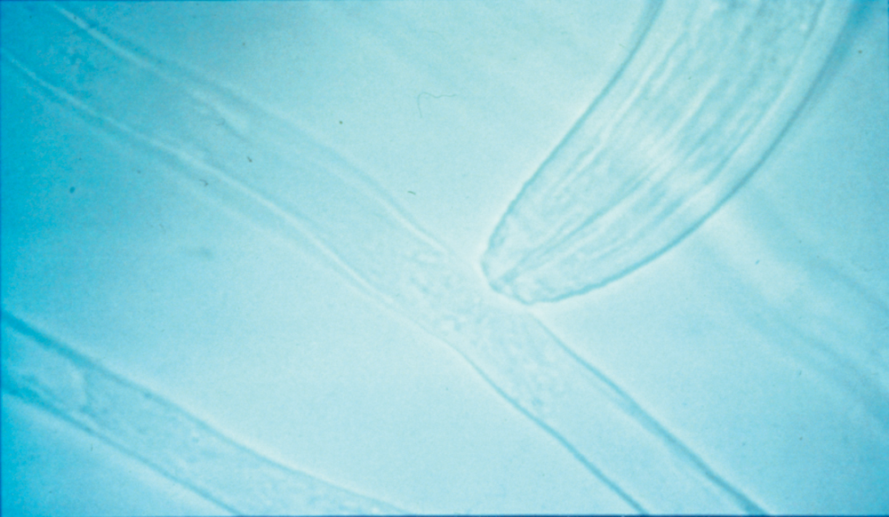 microscopic view of nematode eating fungus