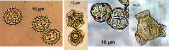 Pollen types shown in a side by side comparison